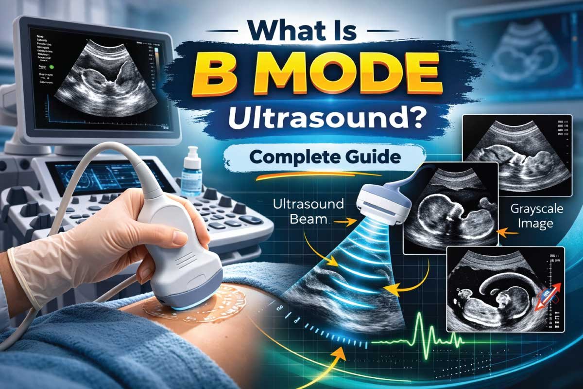 What Is B Mode Ultrasound