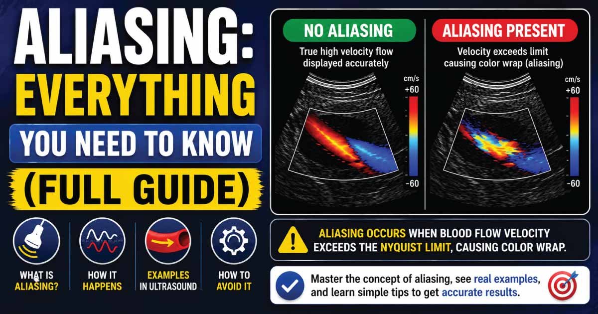 Aliasing: Everything You Need to Know