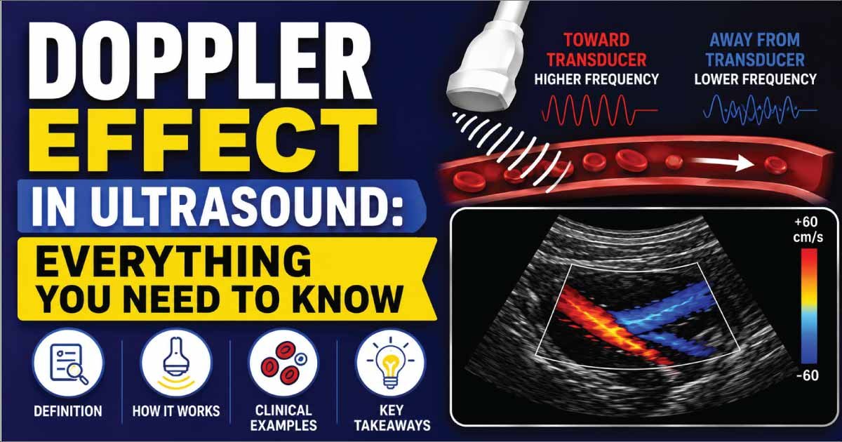 Doppler Effect